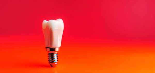 The Role Of The Jawbone In Dental Implant Placement
