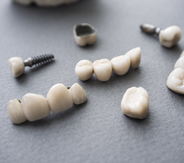 Manhattan Beach The Difference Between Dental Implants and Mini Dental Implants
